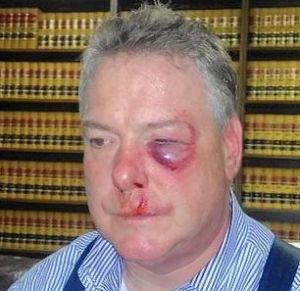 Orange County prosecutor attacks defense attorney??? James Crawford - 